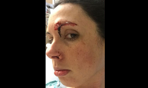 Police say a homeless man attempted to rape Kelly in the public bathroom at Golden Gardens. (KIRO 7...