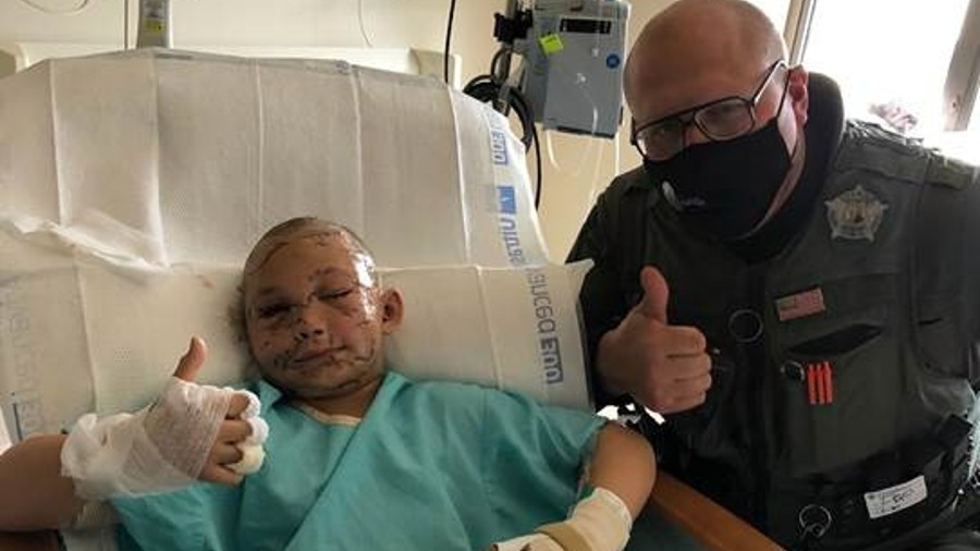 Lily Kryzhanivskyy recovering from a cougar attack...