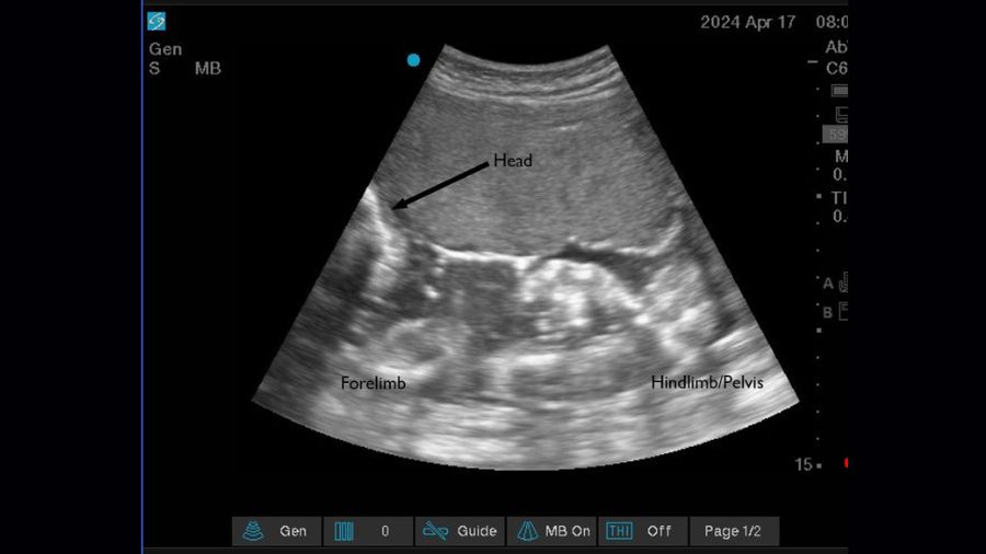 Photo: Ultrasound of Akenji's baby. Akenji is a gorilla at the Woodland Park Zoo....