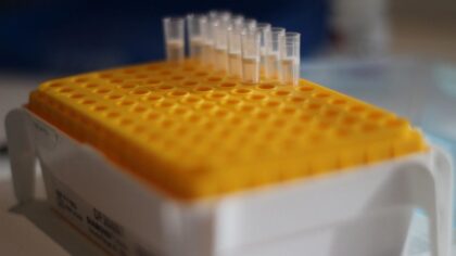 Everett lab owner gets 2 years in prison for $1M Medicare fraud scheme