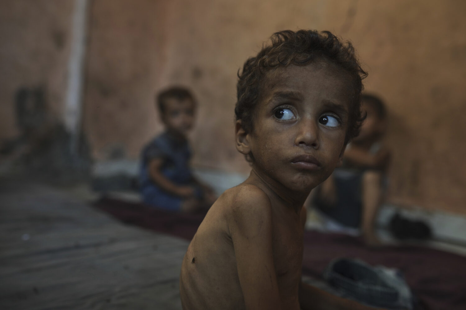 Yazan Abu Ful, a 2-year-old malnourished child, sits at his family home in the Shati refugee camp i...