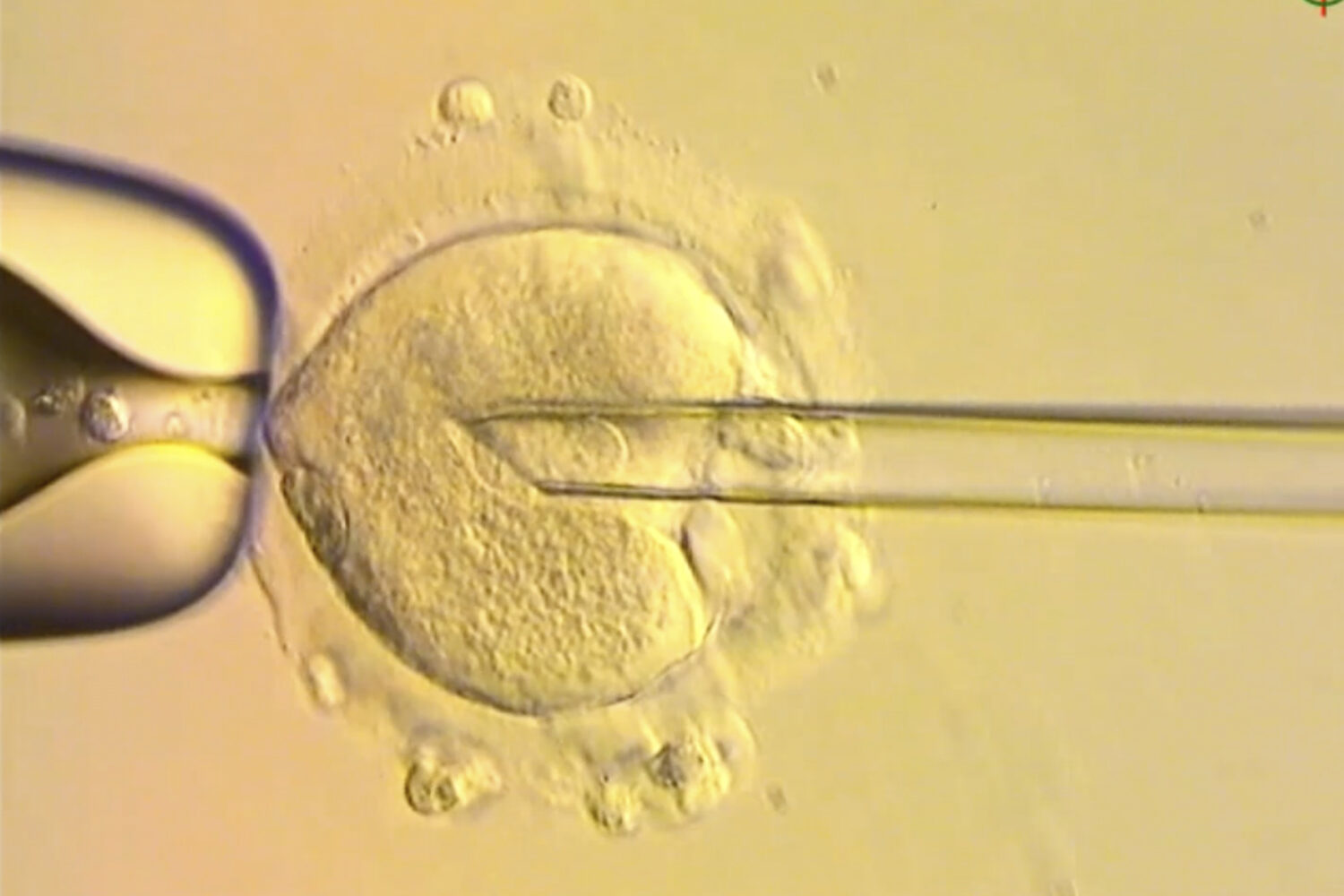 This image from video provided by the Newcastle Fertility Centre shows a nuclear genome from an egg...