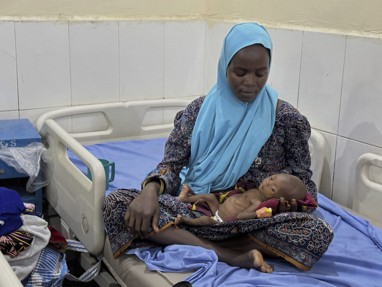 FILE - A malnourished child receives treatment at the Intersos facility, an Italian humanitarian or...