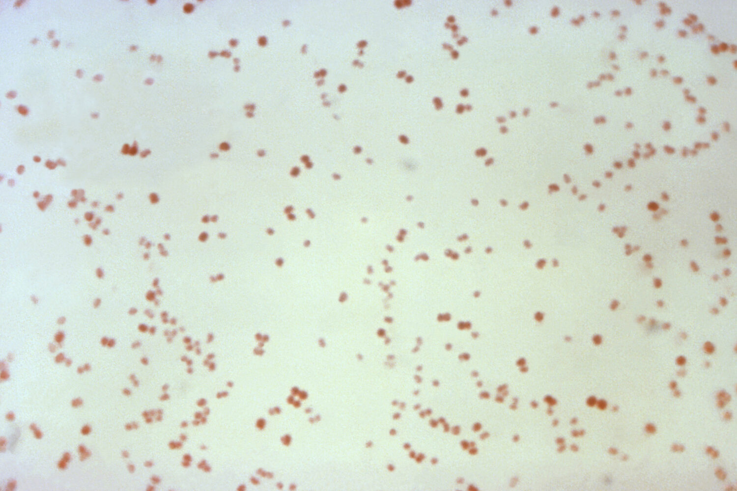 FILE - This 1971 microscope photo provided by the Centers for Disease Control and Prevention shows ...