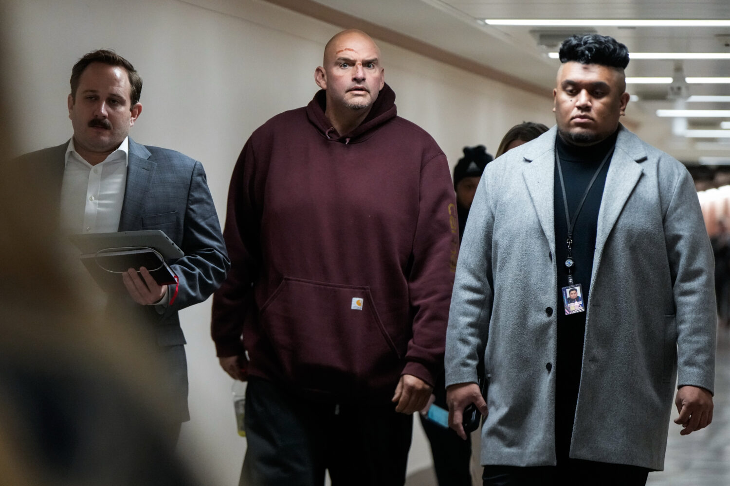 Injuries from a fall are seen on the face of Sen. John Fetterman, D-Pa., second from left, as he wa...