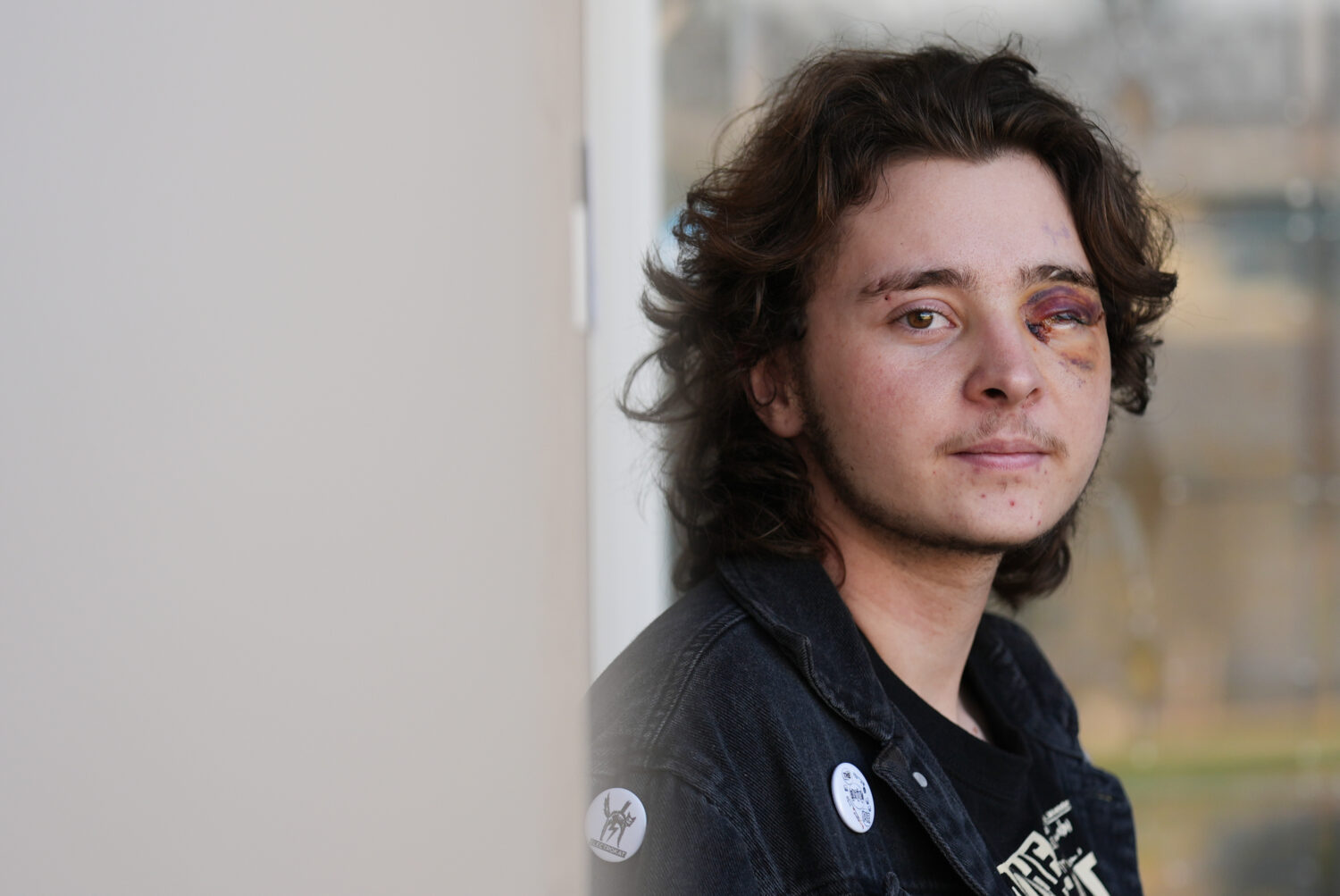 Kaden Rummler, who was injured after being hit with a projectile fired by a federal agent during a ...