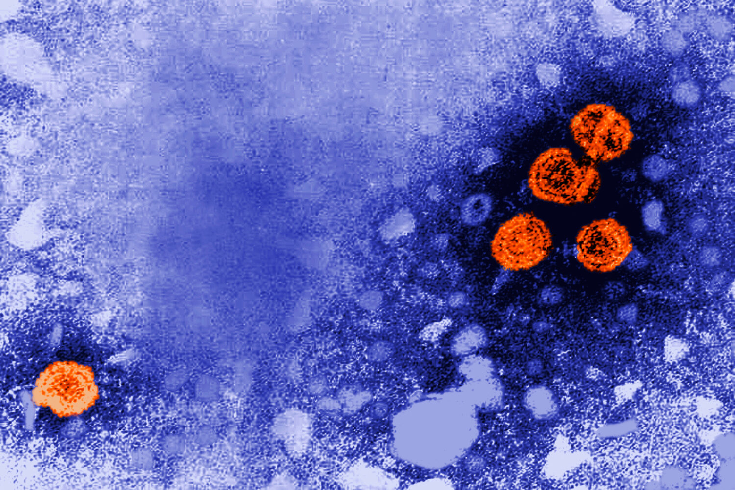 FILE - This 1981 electron microscope image made available by the U.S. Centers for Disease Control a...